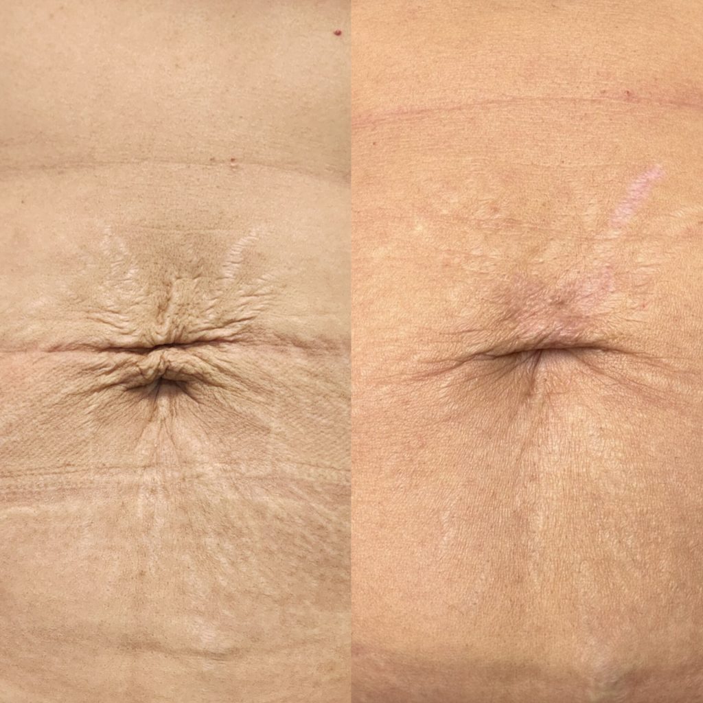 Tulips Skin Clinic gallery 13